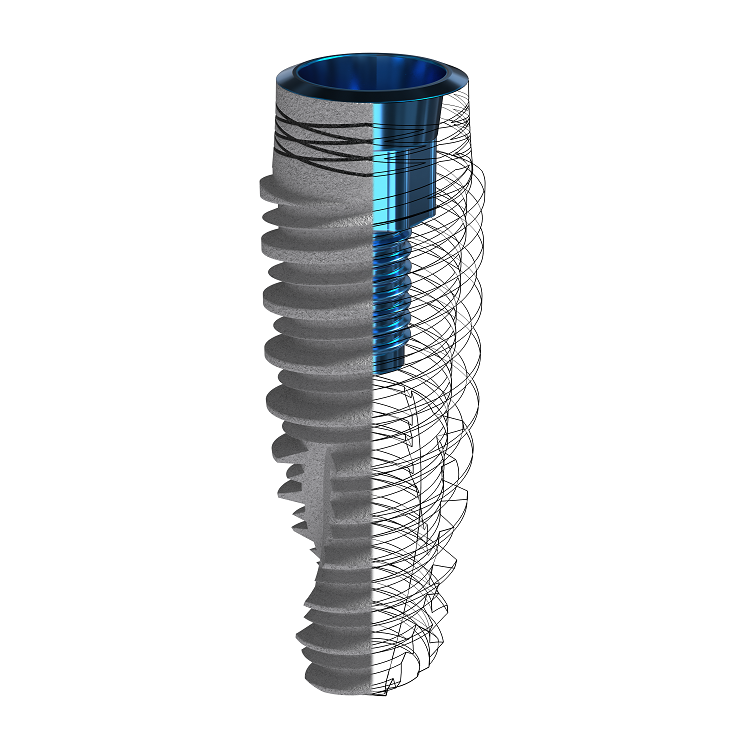 Картинка Имплантат с конической платформой  d3.75mm L16mm I-ON I5C 3.75,16 2 из 3 